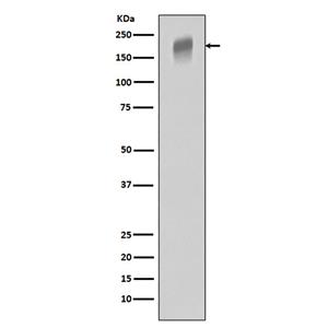 VEGF Receptor 1兔多抗,VEGF Receptor 1 Rabbit Polyclonal Antibody