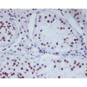 HDAC1兔多抗,HDAC1 Rabbit Polyclonal Antibody