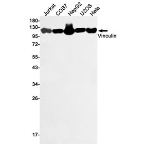 Vinculin兔多抗,Vinculin Rabbit Polyclonal Antibody