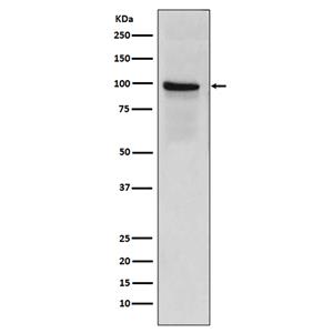 Thrombomodulin兔多抗,Thrombomodulin Rabbit Polyclonal Antibody