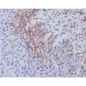 Thrombomodulin兔多抗,Thrombomodulin Rabbit Polyclonal Antibody