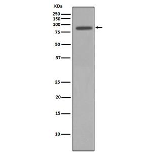 Nibrin兔多抗,Nibrin Rabbit Polyclonal Antibody