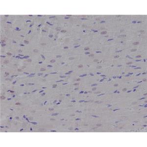 Nibrin兔多抗,Nibrin Rabbit Polyclonal Antibody