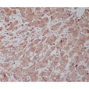 gamma Tubulin兔多抗,gamma Tubulin Rabbit Polyclonal Antibody