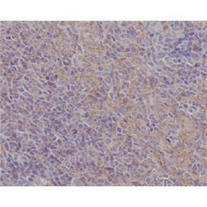 FAK兔多抗,FAK Rabbit Polyclonal Antibody
