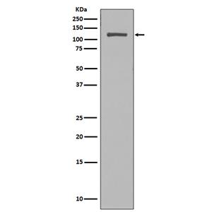 NUP98兔多抗,NUP98 Rabbit Polyclonal Antibody