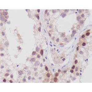 NUP98兔多抗,NUP98 Rabbit Polyclonal Antibody