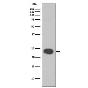 HP1 alpha兔多抗,HP1 alpha Rabbit Polyclonal Antibody