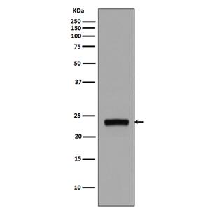 Rab5兔多抗,Rab5 Rabbit Polyclonal Antibody