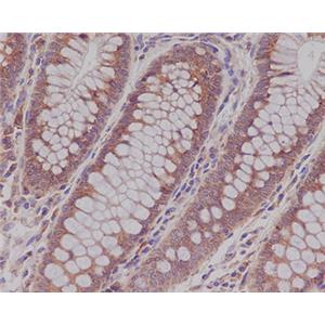 Rab5兔多抗,Rab5 Rabbit Polyclonal Antibody