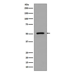 FLI1兔多抗,FLI1 Rabbit Polyclonal Antibody
