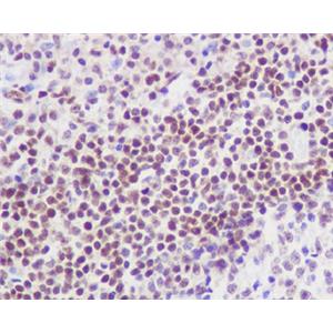 FLI1兔多抗,FLI1 Rabbit Polyclonal Antibody