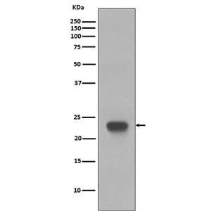 CD3 epsilon兔多抗,CD3 epsilon Rabbit Polyclonal Antibody