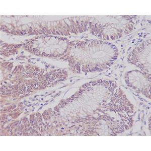 CD3 epsilon兔多抗,CD3 epsilon Rabbit Polyclonal Antibody