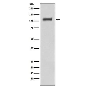 Daxx兔多抗,Daxx Rabbit Polyclonal Antibody