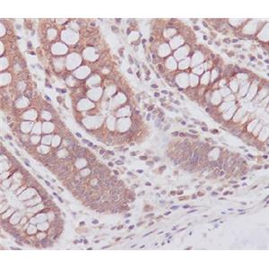 ATG7兔多抗,ATG7 Rabbit Polyclonal Antibody