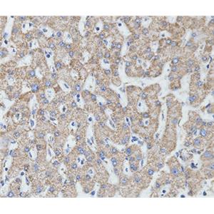 MTCO2兔多抗,MTCO2 Rabbit Polyclonal Antibody