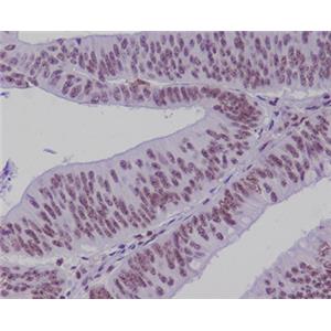 Transcription Factor 7 Like 2兔多抗,Transcription Factor 7 Like 2 Rabbit Polyclonal Antibody