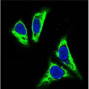 TNFAIP3兔多抗,TNFAIP3 Rabbit Polyclonal Antibody