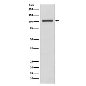 INPP4B兔多抗,INPP4B Rabbit Polyclonal Antibody