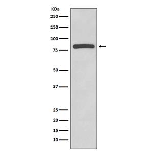 Glycogen Synthase 1兔多抗,Glycogen Synthase 1 Rabbit Polyclonal Antibody