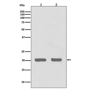 IL-1 Receptor Antagonist Protein兔多抗,IL-1 Receptor Antagonist Protein Rabbit Polyclonal Antibody