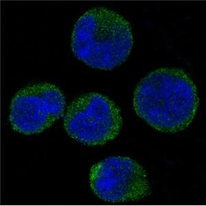 CDK6兔多抗,CDK6 Rabbit Polyclonal Antibody