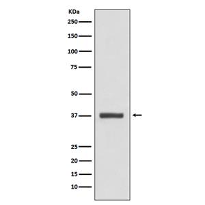 CDK6兔多抗,CDK6 Rabbit Polyclonal Antibody