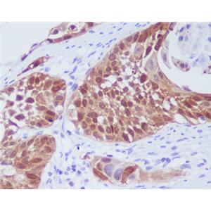 CDK6兔多抗,CDK6 Rabbit Polyclonal Antibody