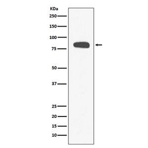 Stromal Interaction Molecule 1兔多抗,Stromal Interaction Molecule 1 Rabbit Polyclonal Antibody