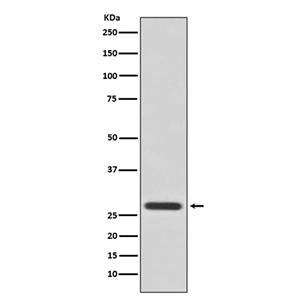 14-3-3 theta兔多抗,14-3-3 theta Rabbit Polyclonal Antibody