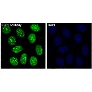 E2F1兔多抗,E2F1 Rabbit Polyclonal Antibody