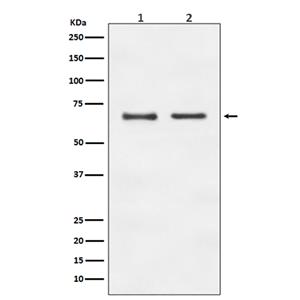 E2F1兔多抗,E2F1 Rabbit Polyclonal Antibody