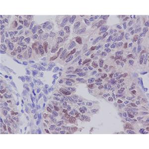 E2F1兔多抗,E2F1 Rabbit Polyclonal Antibody