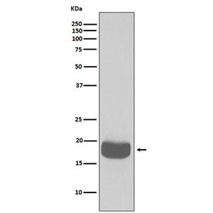 4E BP1兔多抗,4E BP1 Rabbit Polyclonal Antibody