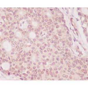 4E BP1兔多抗,4E BP1 Rabbit Polyclonal Antibody