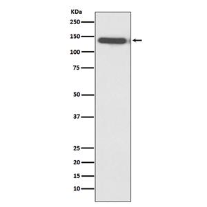 Ctip2兔多抗,Ctip2 Rabbit Polyclonal Antibody