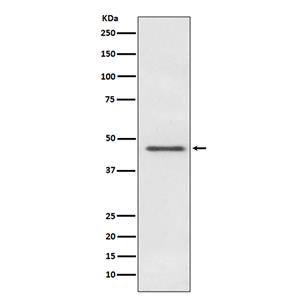 Pyruvate Dehydrogenase E1 alpha兔多抗,Pyruvate Dehydrogenase E1 alpha Rabbit Polyclonal Antibody