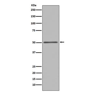 FOXA1兔多抗,FOXA1 Rabbit Polyclonal Antibody