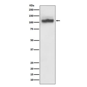 SERCA2 ATPase兔多抗,SERCA2 ATPase Rabbit Polyclonal Antibody