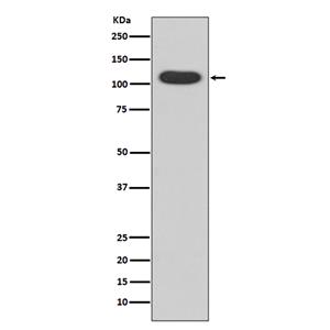 Aryl Hydrocarbon Receptor兔多抗,Aryl Hydrocarbon Receptor Rabbit Polyclonal Antibody