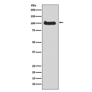 PKD1兔多抗,PKD1 Rabbit Polyclonal Antibody