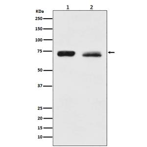 NF2兔多抗,NF2 Rabbit Polyclonal Antibody