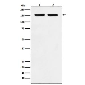 ROCK2兔多抗,ROCK2 Rabbit Polyclonal Antibody