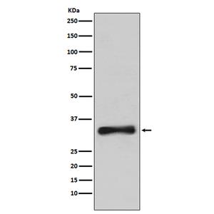 Emerin兔多抗,Emerin Rabbit Polyclonal Antibody