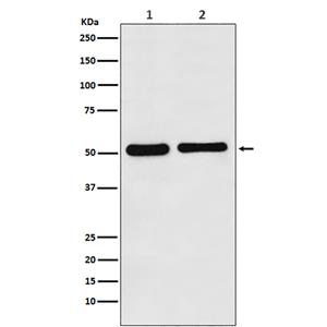 Fascin兔多抗,Fascin Rabbit Polyclonal Antibody
