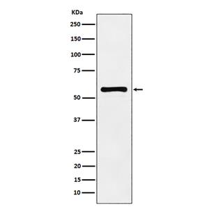 PAK2兔多抗,PAK2 Rabbit Polyclonal Antibody