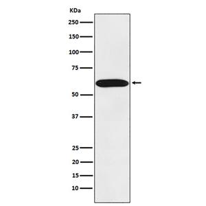 STIP1兔多抗,STIP1 Rabbit Polyclonal Antibody