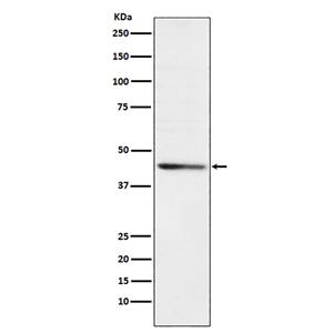 RRM2兔多抗,RRM2 Rabbit Polyclonal Antibody