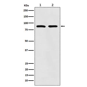 Thrombopoietin Receptor兔多抗,Thrombopoietin Receptor Rabbit Polyclonal Antibody